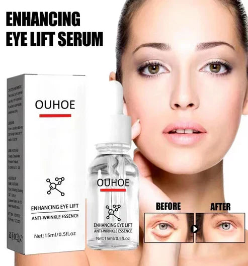 Ouhoe™ Serum Removedor De  Olheiras